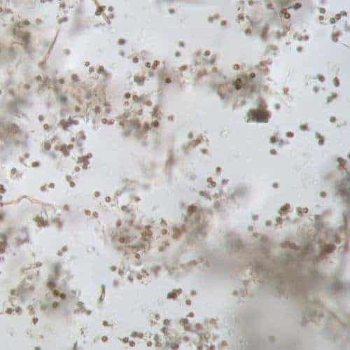 Mushroom spores image - microscope